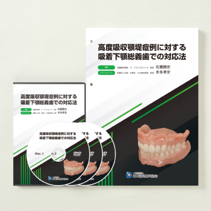 認定医講座DVD「高度吸収顎堤症例に対する吸着下顎総義歯での対応法」